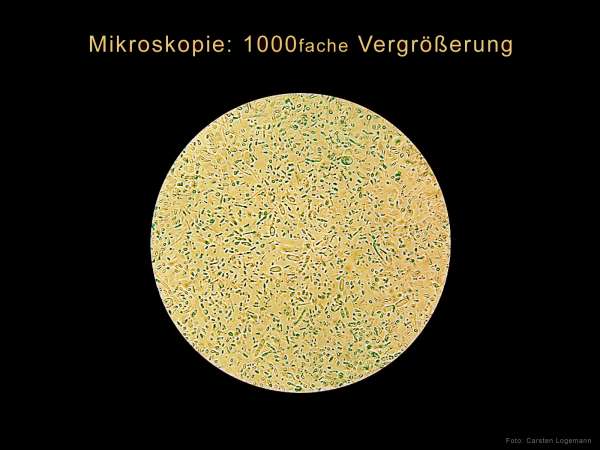 Die Keimbelastung im Aquarium